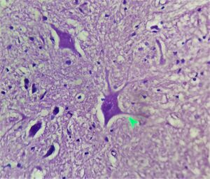 Dendrites of neural tissue.jpg